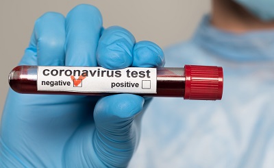Koronawirus anty-SARS-CoV-2, IgG/IgM, test ilościowy/półilościowy