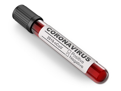 Koronawirus anty-SARS-CoV-2, IgG, test ilościowy