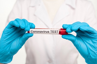 Koronawirus anty-SARS-CoV-2, IgM, test jakościowy, met. ELISA