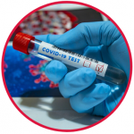 Test na koronawirusa SARS-CoV-2, COVID-19