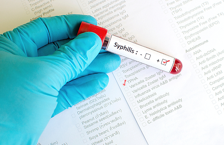 kiła syfilis badanie krwi
