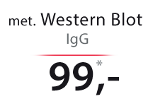 Western Blot IgG